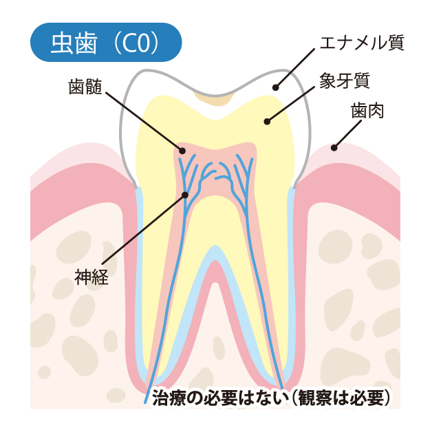 今治で虫歯と歯周病の治療 予防なら越智歯科医院へ