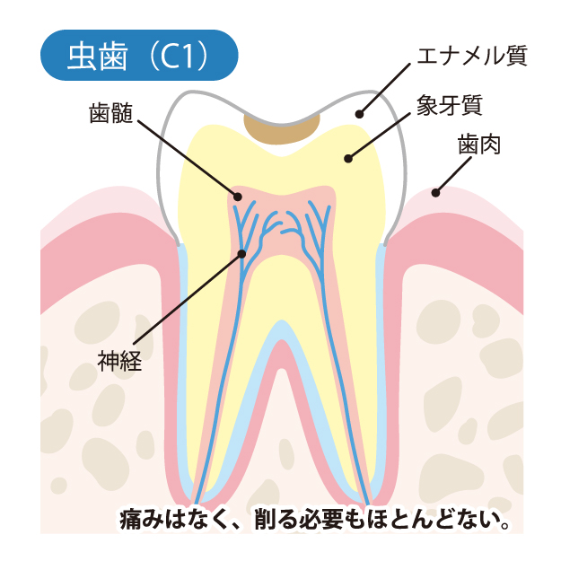 C1